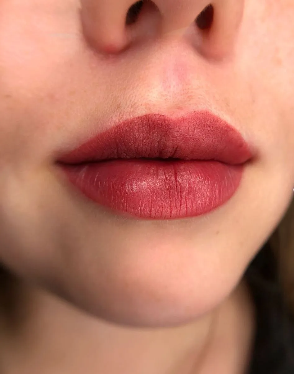 Do lip tattoos mess with lip fillers?