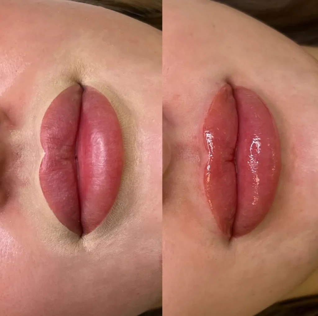 Aftercare Tips to Prevent Cold Sores and Speed Up Healing